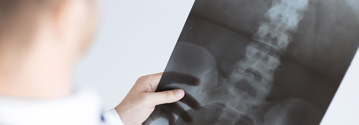 Chiropractic Greenville TX X-ray Holding Chiropractic Greenville TX X-ray Holding
